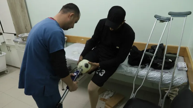 V Gaze, ktorá je pod izraelskou blokádou, Palestínčania čakajú celé mesiace, kým dostanú protetickú končatinu