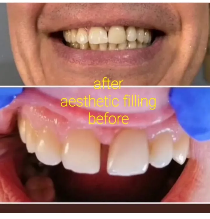 Alanya HEALTHY TEETH Dental Aesthetic — Medicina en Alanya: Pedido online, precios y opiniones