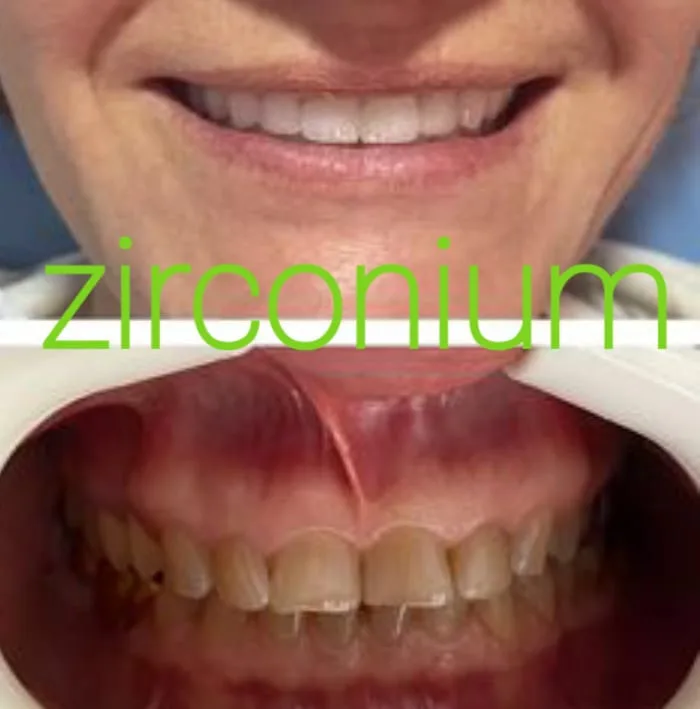 Alanya HEALTHY TEETH Dental Aesthetic — Medicina en Alanya: Pedido online, precios y opiniones