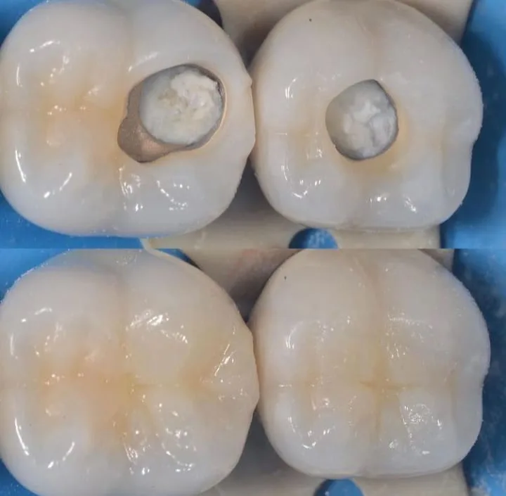 Alanya HEALTHY TEETH Dental Aesthetic — Medicina en Alanya: Pedido online, precios y opiniones