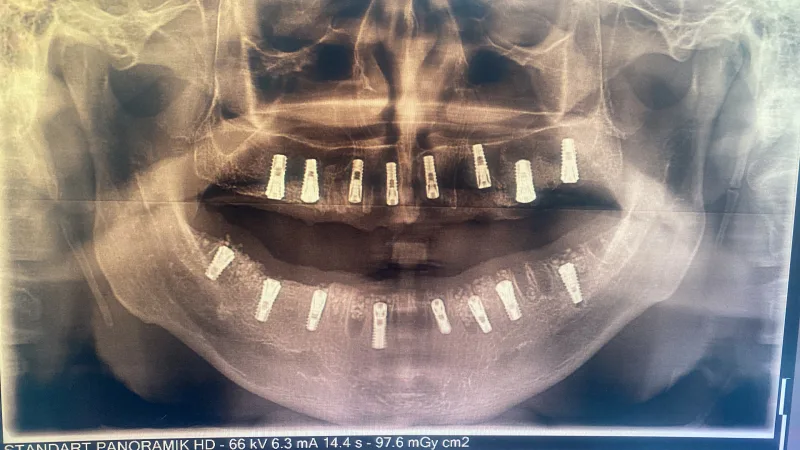 Alanya HEALTHY TEETH Dental Aesthetic — Medicina en Alanya: Pedido online, precios y opiniones