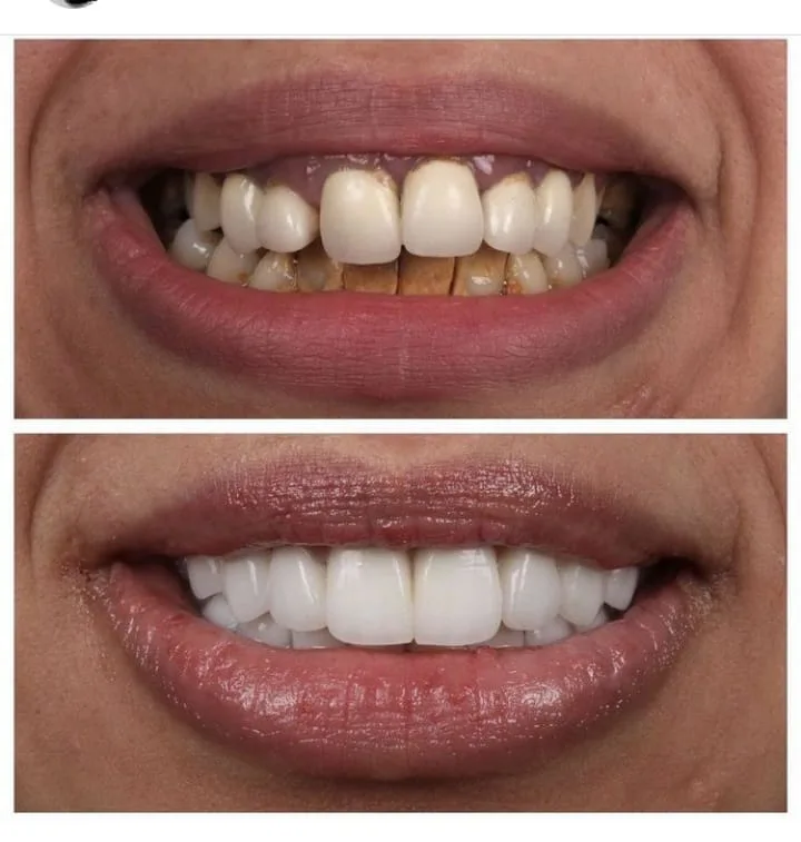 Alanya HEALTHY TEETH Dental Aesthetic — Medicina en Alanya: Pedido online, precios y opiniones