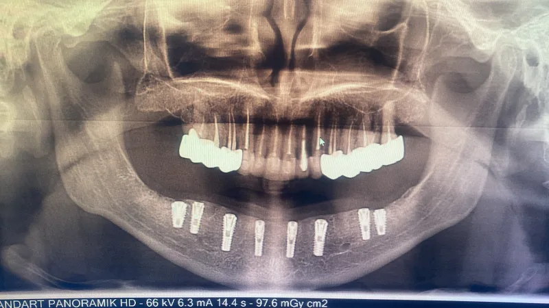 Alanya HEALTHY TEETH Dental Aesthetic — Medicina en Alanya: Pedido online, precios y opiniones