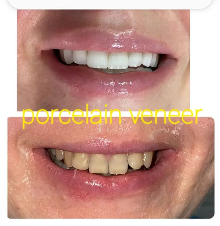 Alanya HEALTHY TEETH Dental Aesthetic — Medicina en Alanya: Pedido online, precios y opiniones