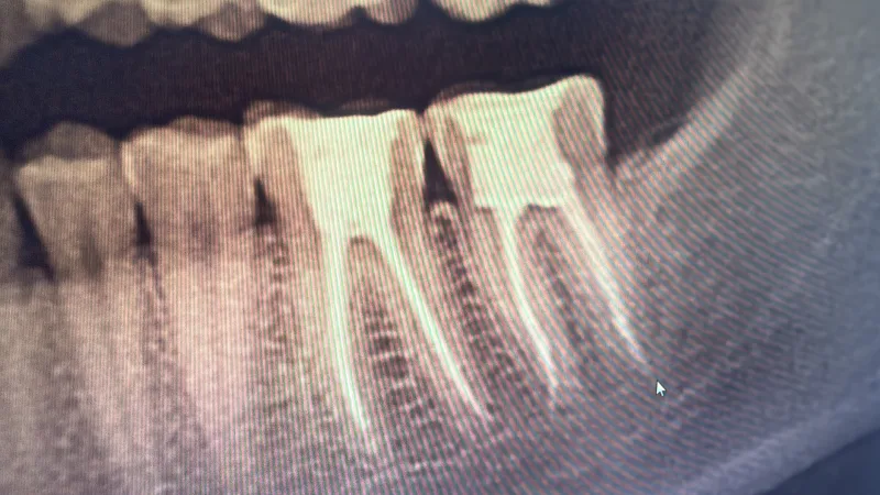 Alanya HEALTHY TEETH Dental Aesthetic — Medicina en Alanya: Pedido online, precios y opiniones