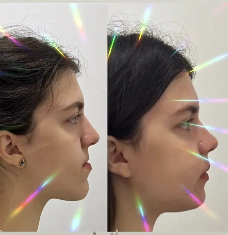 Alanya HEALTHY TEETH Dental Aesthetic — Medicina en Alanya: Pedido online, precios y opiniones